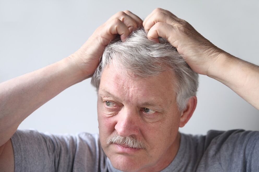 Symptômes du psoriasis sur la tête