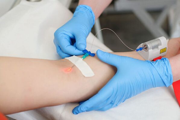 traitement au laser intraveineux pour le psoriasis sur les jambes