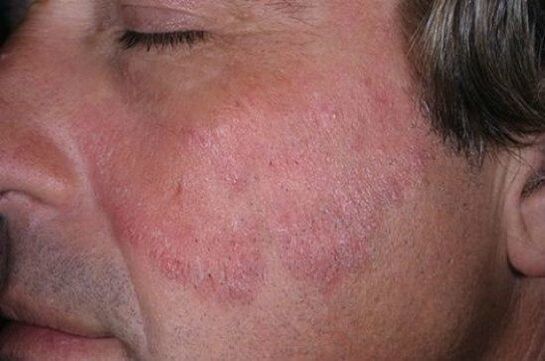 Sur le visage