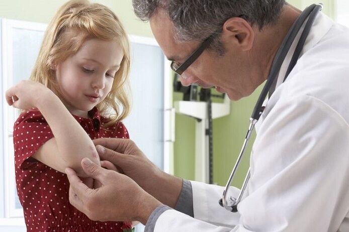 Le psoriasis à un jeune âge